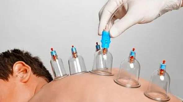 چه افرادی نباید حجامت کنند؟