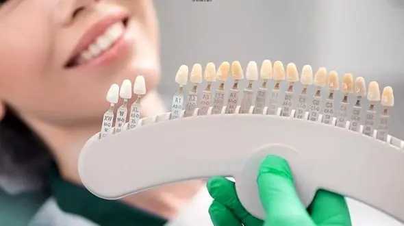 قیمت ایمپلنت دندان بر چه اساسی تعیین می شود؟