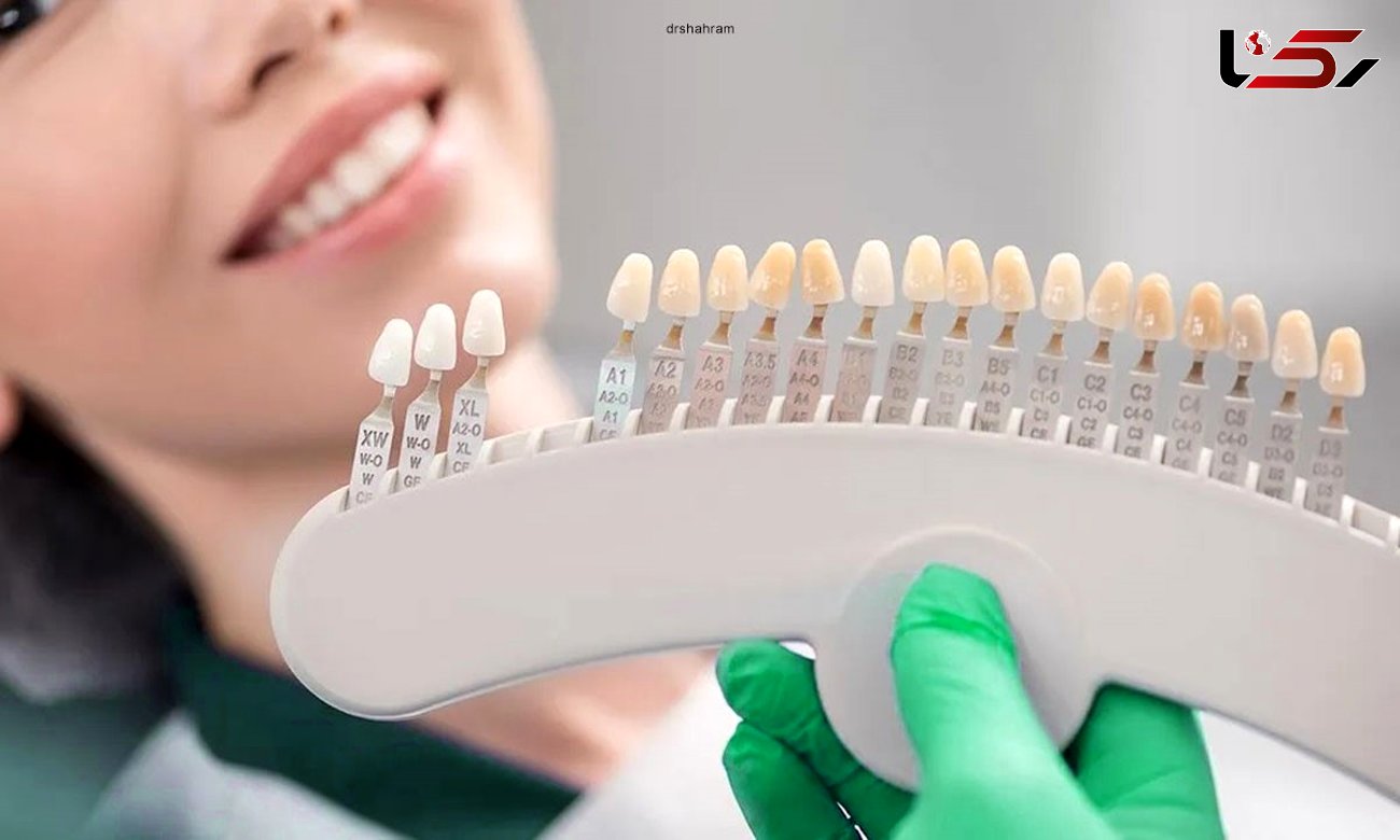 قیمت ایمپلنت دندان بر چه اساسی تعیین می شود؟