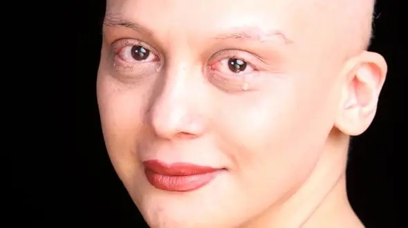 چهره جذاب خانم بازیگر بعد شکست سرطان ! / مارال فرجاد به زندگی بازگشت ! + عکس ها