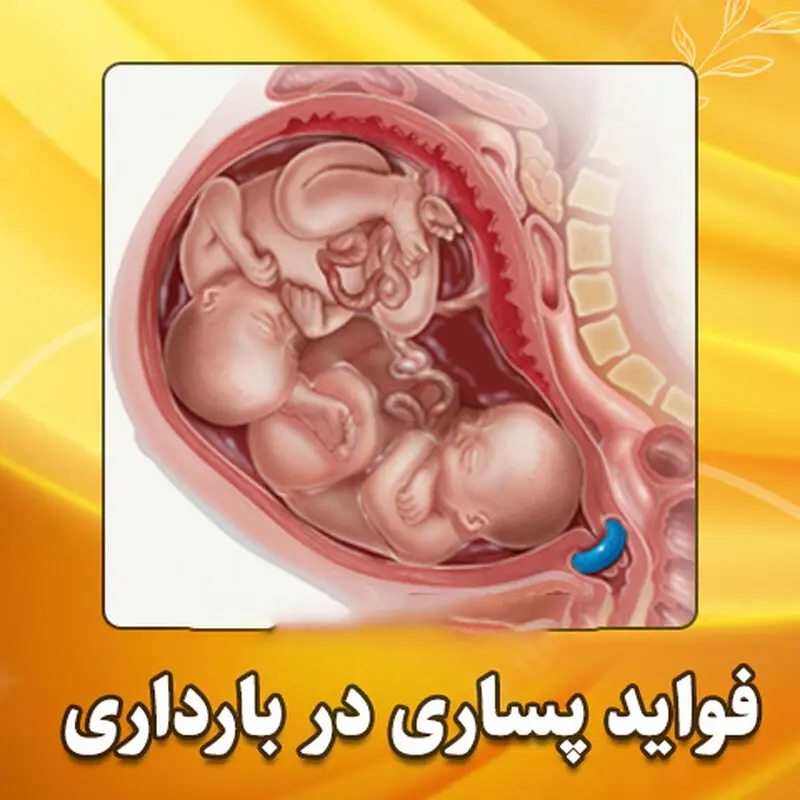 پساری در بارداری