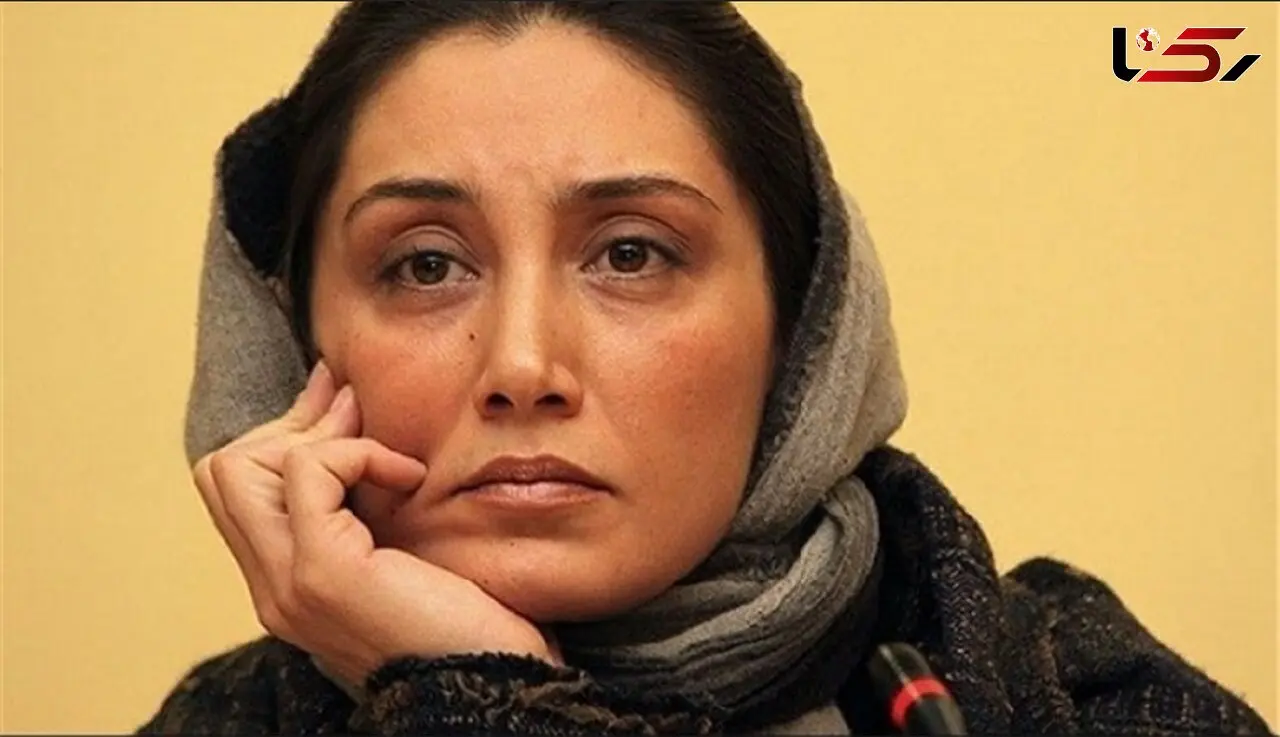 زیباترین چهره هدیه تهرانی که شوکه تان می کند !  + عکس حیرت آور از چهره داغون خانم بازیگر !