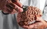 تاثیرات استرس مزمن بر مغز: از حافظه تا تمرکز / پاسخ به پرسش های کاربران