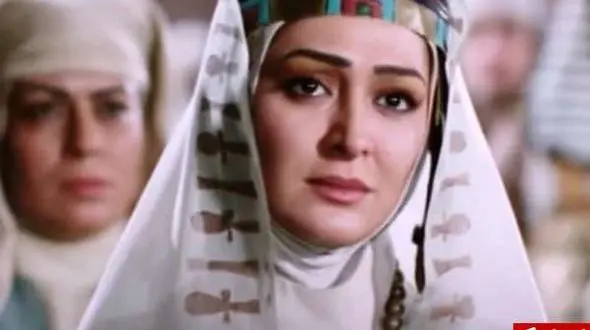 چهره مصنوعی الهام حمیدی بعد از عجیب ترین عمل زیبایی جهان + عکس های هوش پران