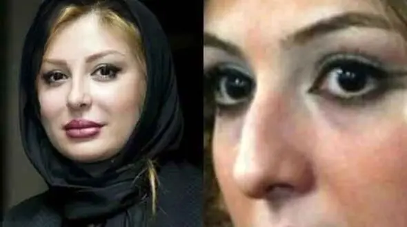 رونمایی از تصاویر قبل عمل زیبایی بازیگران زن ایرانی/ از شیلا خداداد تا نیوشا ضیغمی+عکس