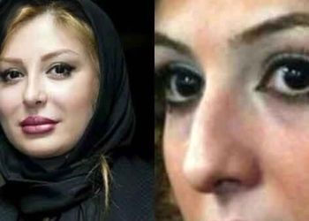 رونمایی از تصاویر قبل عمل زیبایی بازیگران زن ایرانی/ از شیلا خداداد تا نیوشا ضیغمی+عکس
