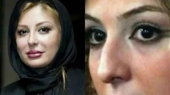 رونمایی از تصاویر قبل عمل زیبایی بازیگران زن ایرانی/ از شیلا خداداد تا نیوشا ضیغمی+عکس