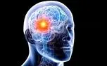 انقلاب در درمان تومور مغزی / سل تراپی؛ سلاح جدید علیه تومورهای مغزی بدخیم