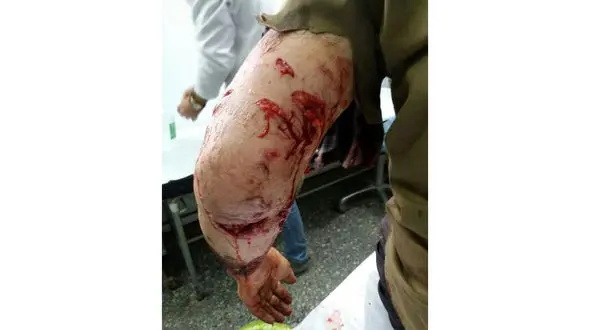 حمله پلنگ به مردی در زنجان +عکس