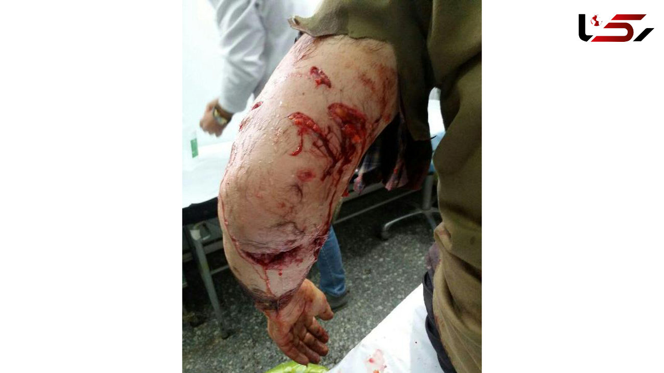 حمله پلنگ به مردی در زنجان +عکس