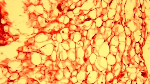 نقش چربی‌های بدن در بروز یا کاهش اضطراب؛ یافته‌های جدید علمی