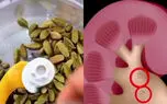 شما هم سنگ کلیه دارین؟ از مصرف هل غافل نشین / فیلم