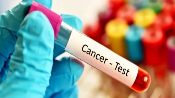 علائمی که به زنان بالای 40 سال هشدار می‌ دهد / ضرورت انجام تست‌ های حیاتی