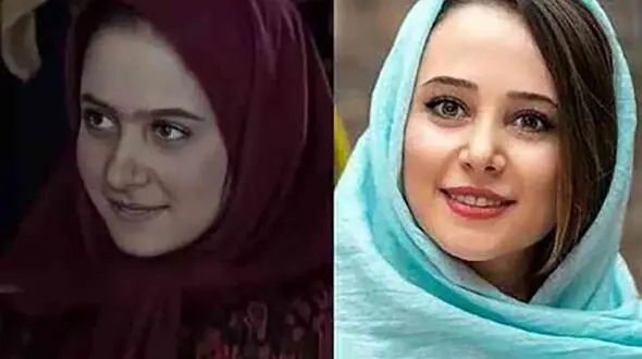 تغییرات زیبایی الناز حبیبی