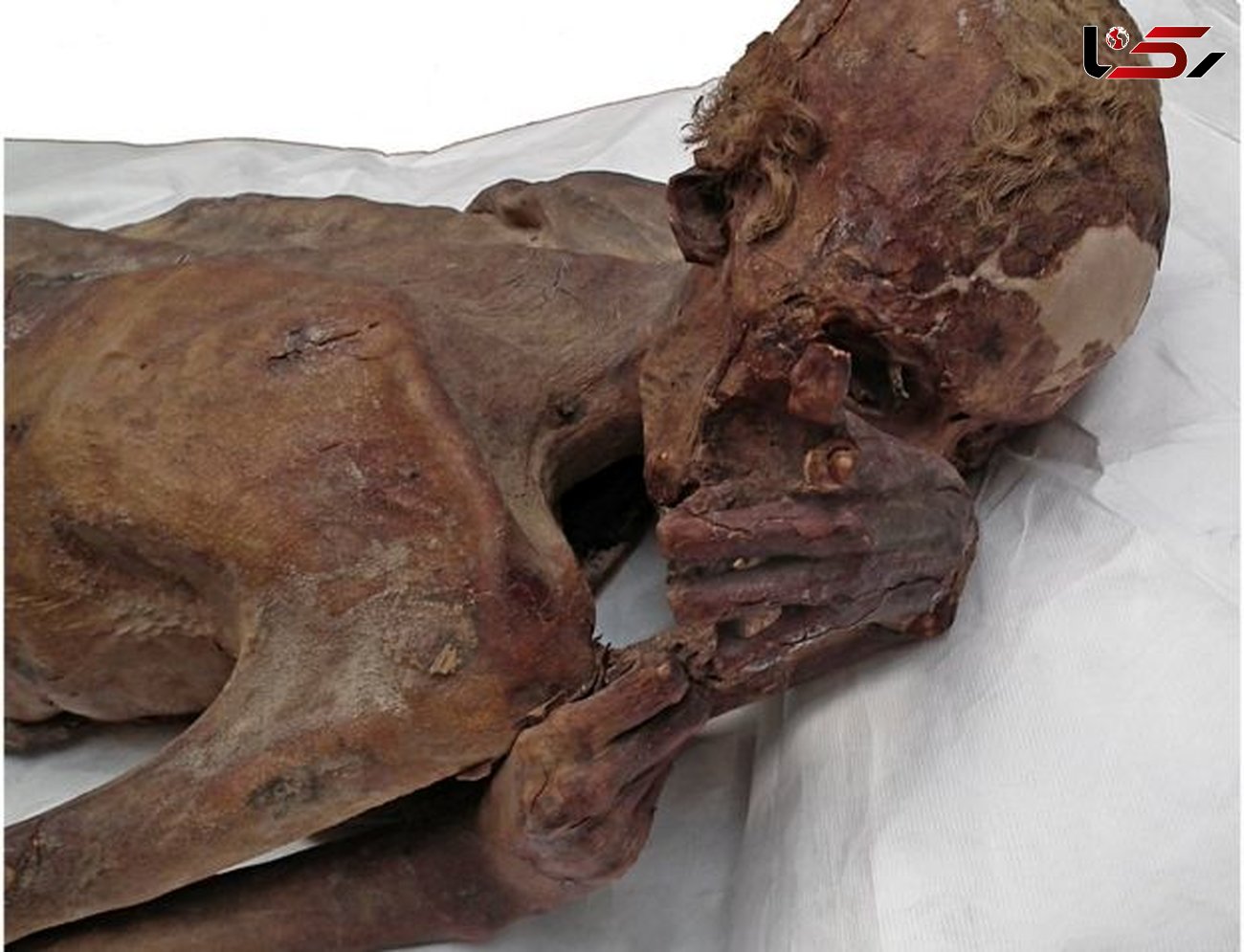 قدیمی‌ترین خالکوبی دنیا روی بازوی یک زن کشف شد + عکس