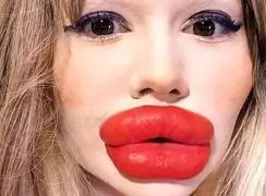 رکورد عجیب زنی با بزرگترین لب دنیا؛ همه چیز درباره هزینه‌ های هنگفت! / عکس
