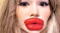 رکورد عجیب زنی با بزرگترین لب دنیا؛ همه چیز درباره هزینه‌ های هنگفت! / عکس