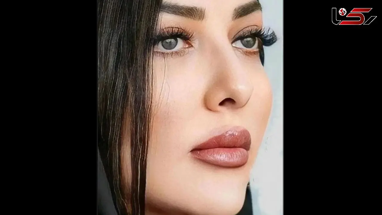  حتما با دیدن چهره ی جدید لیلا اوتادی شوکه می شوید