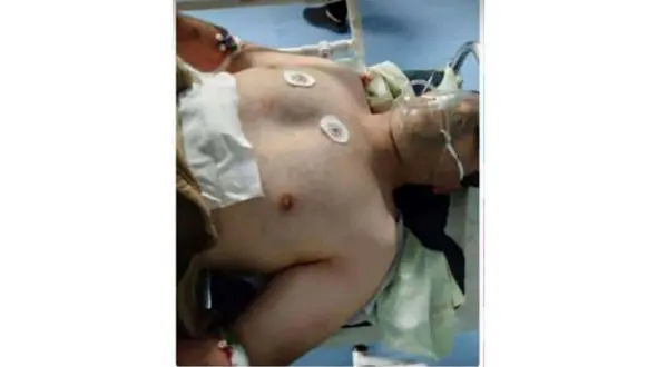 تیراندازی سارقان وقیح به پلیس شوش در روز روشن  + عکس 