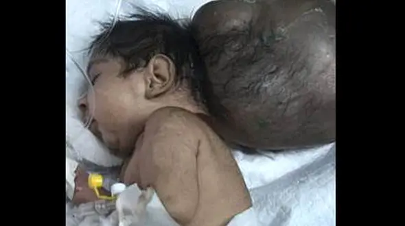 دفن زنده زنده نوزاد با دو سر توسط پدرش + عکس