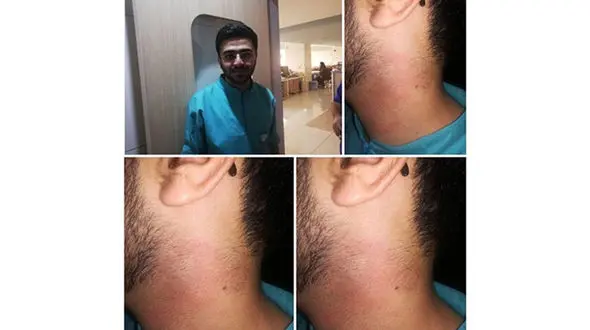 جزییات دقیق کتک خوردن پرستار شیرازی از آقای دکتر / خانم پرستار کم مانده بود بچه داخل شکمش را بیندازد! + عکس ها