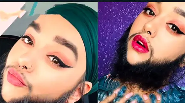 ازدواج دختر ریش دار جهان ! + لباس عروس زیبایش را ببینید