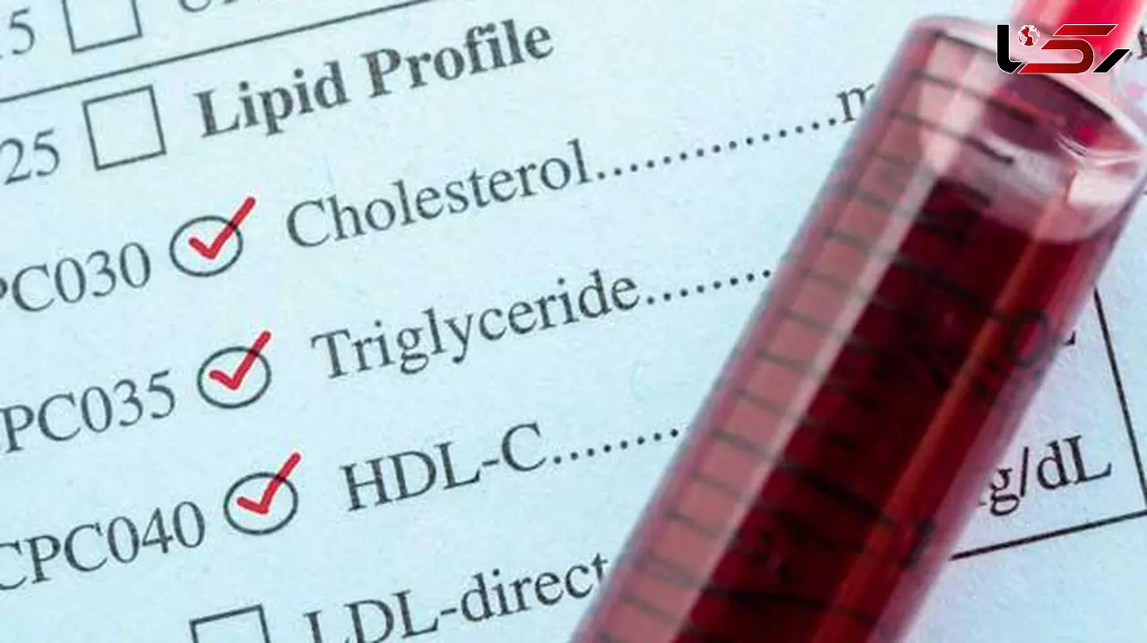 h.d.l چیست ؟ + جدول درمان خانگی برای افزایش کلسترول خوب