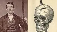مردی که میله آهنی از مغزش عبور کرد اما زنده ماند/ چه اتفاقی برای شخصیتش افتاد؟