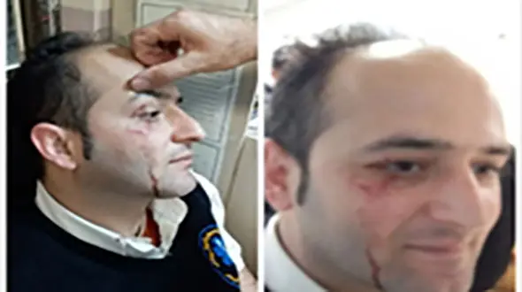 عکس / کتک کاری وحشتناک تکنسین اورژانس توسط3 شرور در گیلان 