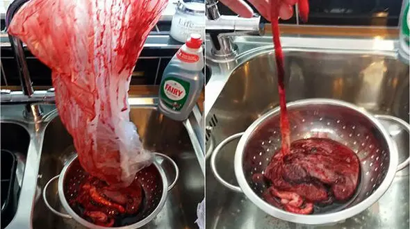 این مرد دیوانه جفت جنین همسرش را خورد + عکس 