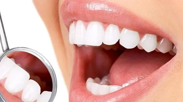  200 میلیون دندان پوسیده در دهان ایرانیان 