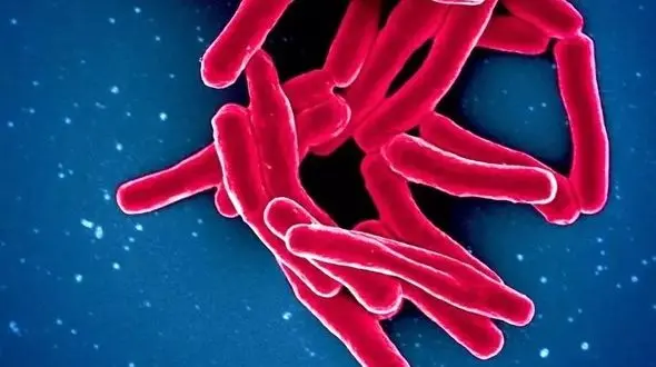 آمار وحشتناک کشنده‌ ترین بیماری عفونی جهان در سال 2024: 1.23 میلیون جان باخته