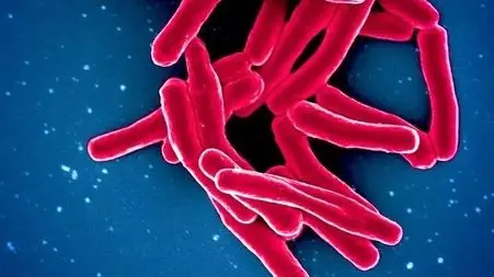 آمار وحشتناک کشنده‌ ترین بیماری عفونی جهان در سال 2024: 1.23 میلیون جان باخته