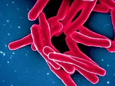 آمار وحشتناک کشنده‌ ترین بیماری عفونی جهان در سال 2024: 1.23 میلیون جان باخته