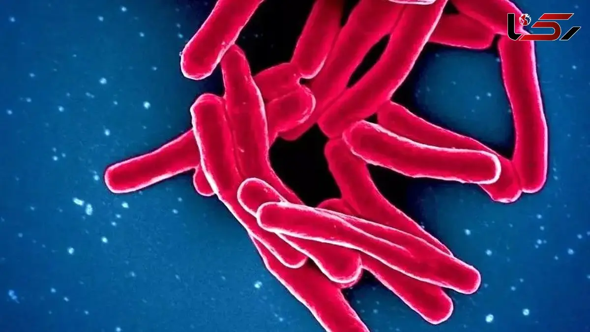 آمار وحشتناک کشنده‌ ترین بیماری عفونی جهان در سال 2024: 1.23 میلیون جان باخته