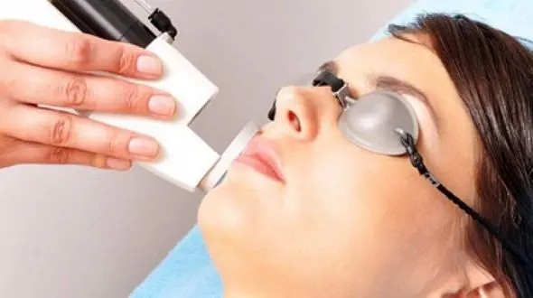 مزایا و خطرات لیزر موهای زائد