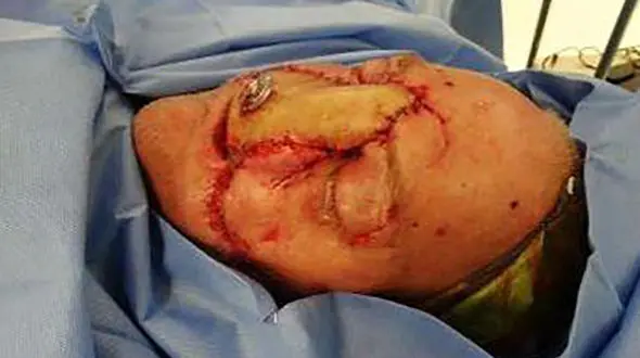 خرس وحشی صورت مردی را تیکه پاره کرد+تصاویر 