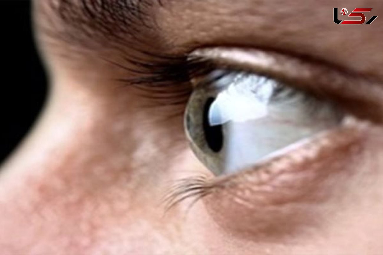 شانه های اولیه پارکینسون از طریق چشم  قابل تشخیص است