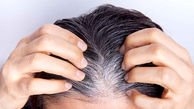 طبیعی ترین درمان های ریزش و سفیدی مو