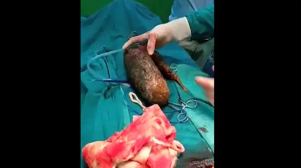 عجیب ترین بلایی که موهای سر یک دختر بر سرش آورد + عکس