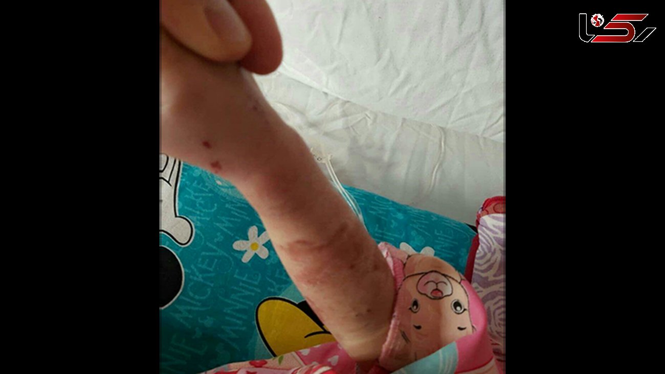 توضیحات رئیس بیمارستان کودکان تبریز از عکسی دردناک در فضای مجازی+ تصاویر تکاندهنده