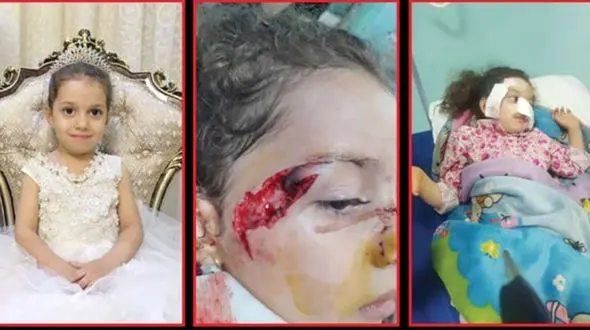 مرگ 3 کودک در حمله سگ های ولگرد در 3 شهر + عکس و جزییات