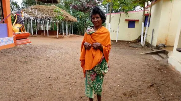 زنی عجیب با 31 انگشت دست و پا + عکس