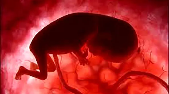 حاملگی خارج رحمی چرا؟ + جزییات