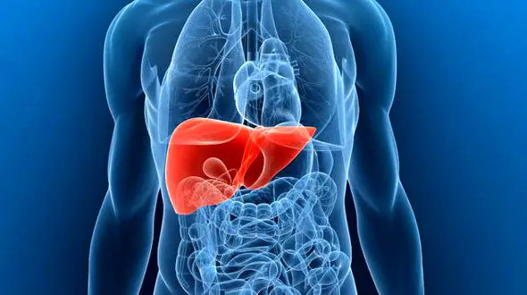 سیروز کبدی چه علائمی دارد؟