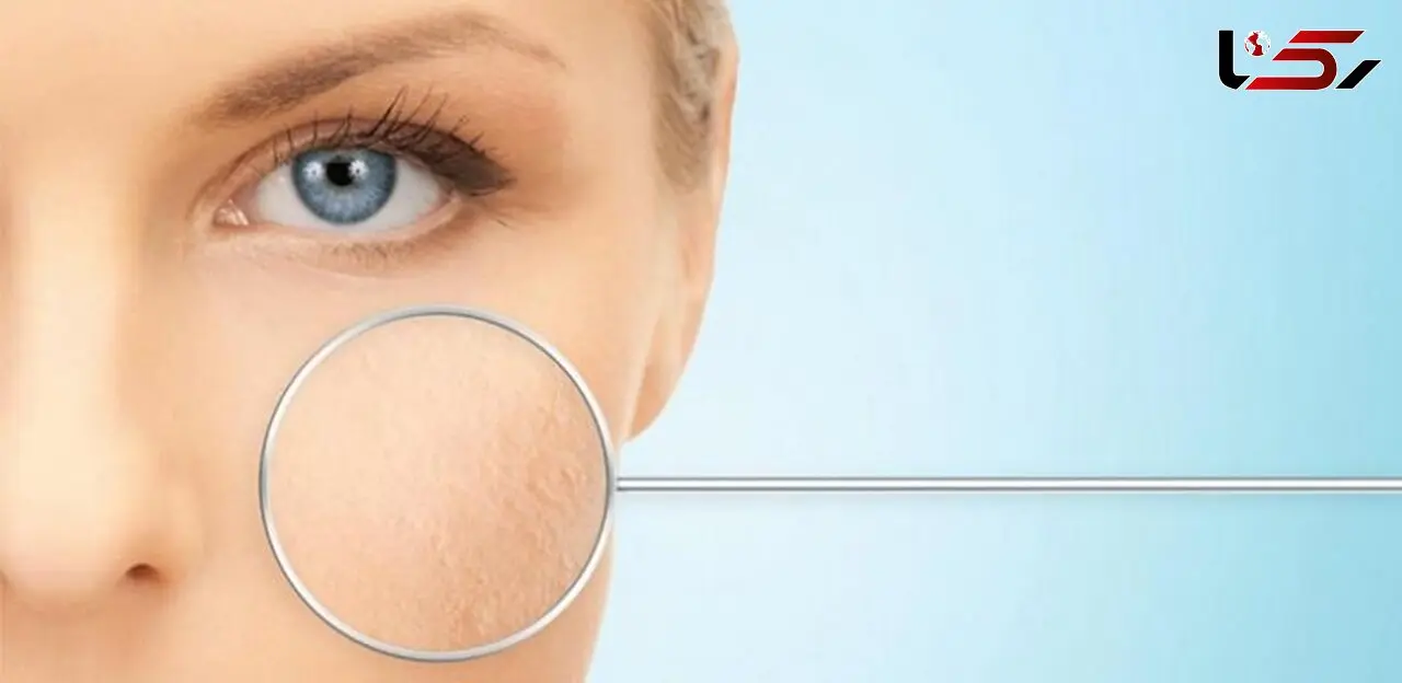 چطور پوستی لطیف و شاداب داشته باشیم؟/راهکارهای رفع خشکی پوست صورت