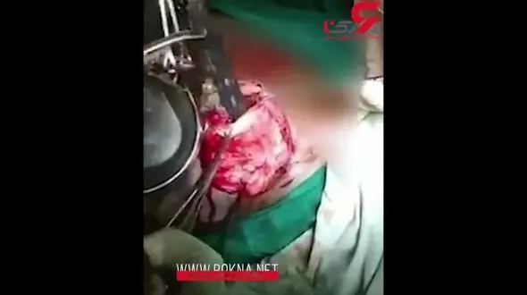 راز عجیب شکم برآمده این زن چه بود؟! +فیلم(16+)