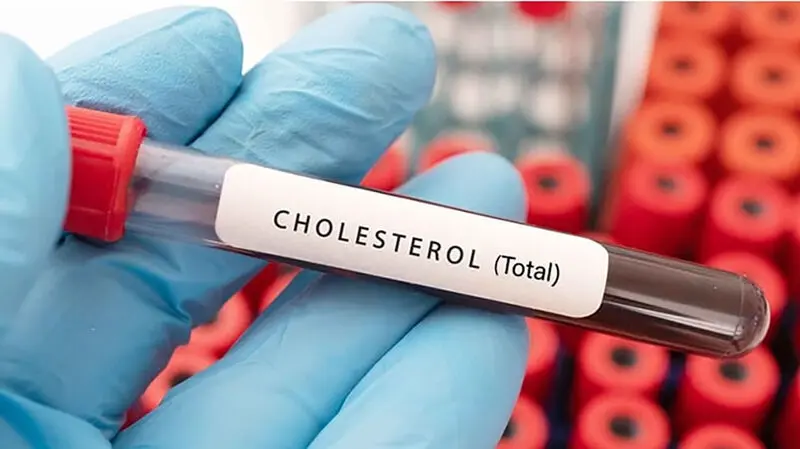 total cholesterol