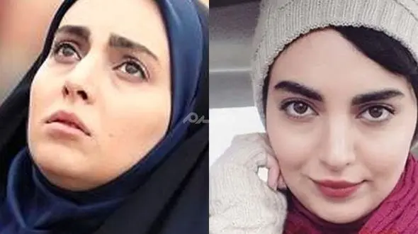 عجیب ترین استوری از  مهشید جوادی بازیگر بچه مهندس/  این عکس نگران کننده برای چیست ؟!