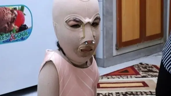  مادر و پدر دنیا جلوی چشمانش زنده زنده در آتش سوختند + عکس تکاندهنده